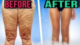 How to get rid of thighs? Top 3 exercises for inner part of thighs for legs' weight loss