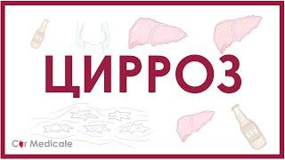 Цирроз печени - причины, патогенез, симптомы, осложнения