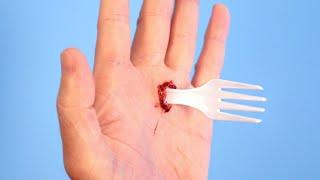 TOP 10 WORST KITCHEN INJURY FAILS!