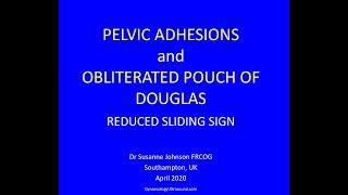 PELVIC ADHESIONS AND FROZEN PELVIS