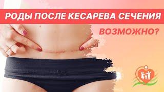  Естественные роды после кесарева сечения. Рубец на матке - возможны ли роды после кесарева?