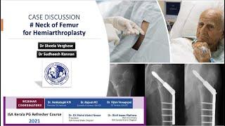 Fracture neck of femur for hemiarthroplasty - Case Discussion | Kerala ISA PG Refresher Course 2021