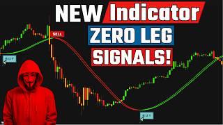 The Zero Lag Indicator: Risk FREE Trading Strategy That Actually Works!