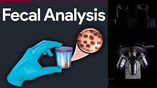 Fecalysis- MICROSCOPIC STOOL ANALYSIS STEP BY STEP GUIDE| |MEDICAL LABORATORY SCIENCE