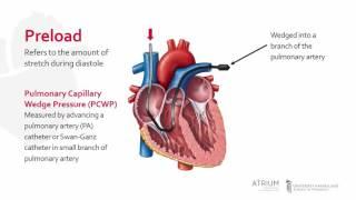 Cardiac Preload