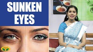 Treatment For Sunken Eyes | Nutrtion Diary | Jaya TV | Adupangarai