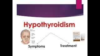 Hypothyroidism l Symptoms l Treatment l Easy Explanation l Myxedema         @ Ayurveda Academy