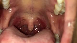 Inside my saliva covered mouth (male vore)