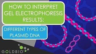 How to Interpret Gel Electrophoresis Results: Different types of plasmid DNA