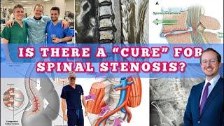 Are there “cures” for spinal stenosis?! 