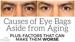 Causes of Puffy Eye Bags Aside from Aging, and Stress Factors than can Make Them Worse