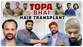 Youtuber Sevengers fame Topa Bhai Hair Transplant | Topa bhai ke Cap se permanent mukti