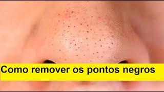 Como remover os pontos negros