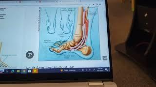 2023-09-21 hsiu Chang pt. Saco Bay physical therapy feet muscle 2. ankle pain flat feet