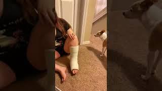 My friend in LEG CAST #legcast