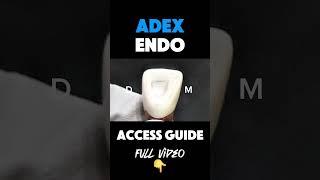 ADEX ENDO ACCESS OPENING QUICK GUIDE #drsung #dentist #ADEX #ADEXENDO