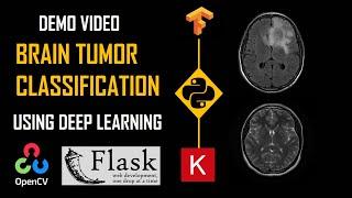 Deep Learning Project:Brain Tumor Classification | DEMO | Keras Python Tensorflow | KNOWLEDGE DOCTOR