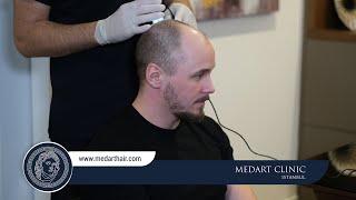 Hair Transplant Turkey | Medart Hair Istanbul