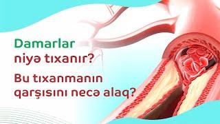 Damarlar niyə tıxanır? Bu tıxanmanın qarşısını necə alaq?