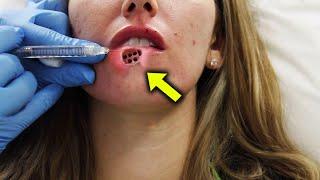 The Doctor Saw Something Emerging from the Girl’s Lip  He Was Stunned