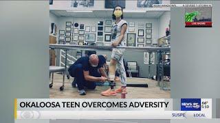 VIDEO: Okaloosa County teen amputee moves forward with new mobility