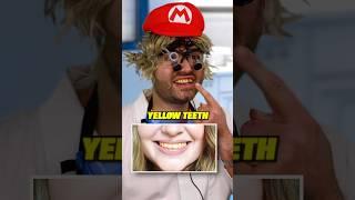 What do you eat…Food vs Teeth!?