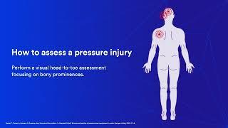 Pressure Injury Education: Chapter 4 Assessment