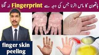 finger skin peeling hathon ka mass utarna