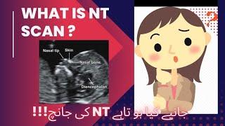 What is NT Scan?|Nuchal Translucency|ch 2lNuchal fold thicknesss|booklet about USG#facts#ntscan