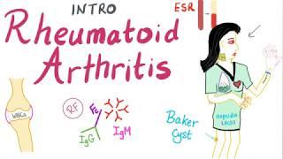 Rheumatoid Arthritis (RA) - Introduction - Autoimmune Disease - Rheumatology Series