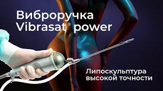 Липоскульптура высокой точности. Вибрационный блок Vibrasat power. Hi-Def lipo using Vibrasat power