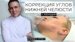 Коррекция углов нижней челюсти у женщин Видео-Урок | Профиль Джоли