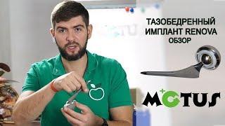 МОТУС ТЕСТ #8 | ТАЗОБЕДРЕННЫЙ ИМПЛАНТ RENOVA