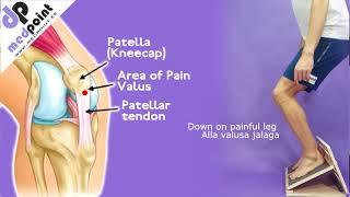 Slant Board Medpoint Knee eccentric Rehab