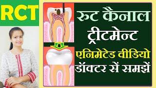 RCT TREATMENT VIDEO | rct in hindi | Root canal treatment in hindi