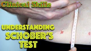 Low Back Pain - Schober's Test - Clinical Skills - Dr Gill