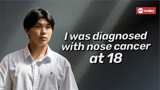 I was diagnosed with nose cancer at 18