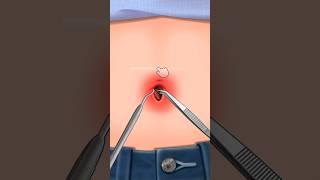 ASMR l Navel Stone Belly Button Ring Remove Animation