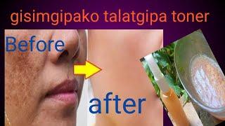 Green tea, potato,glove, rice water face toner , melasma revome# Momin nokkrom mix tv