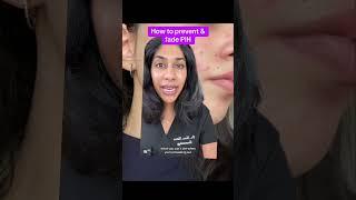 Post acne mark tips from a dermatologist #hyperpigmentation #skincare