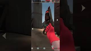 Medic - the WORST class for start! TF2 beginners guide