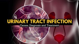 Urinary Tract Infection, Causes, Signs and Symptoms, Diagnosis and Treatment.