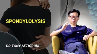 SPONDYLOLYSIS, THE SILENT CAUSE OF BACK PAIN  | SECOND OPINION - DR TONY SETIOBUDI