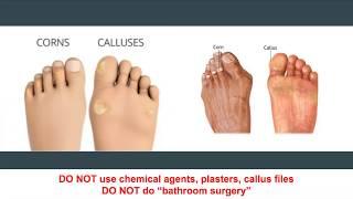 Diabetes Foot Care Guidelines