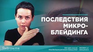 Последствия микроблейдинга #микроблейдинг