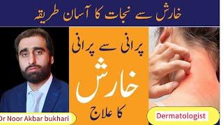 KHARISH KA ILAJ - Scabies Treatment In Urdu - Kharish Khatam Karne Ka Tarika