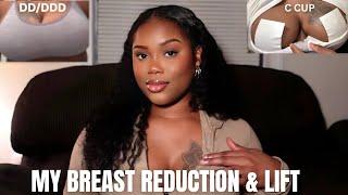 MY BREAST REDUCTION & LIFT: Insurance approval, Pain, Recovery, Surgeon & more