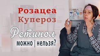 Ретинол и чувствительная кожа | Подходы и исследования  | Розацеа или купероз |  Ниацинамид и др.