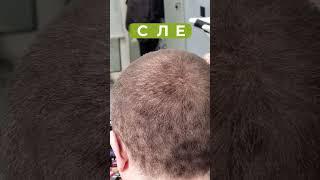 КАК скрыть редкий пробор и залысины за 30 секунд? ОТВЕТ - SEVICH #hair #волосы #shorts #лысый