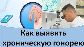 Как выявить хроническую гонорею